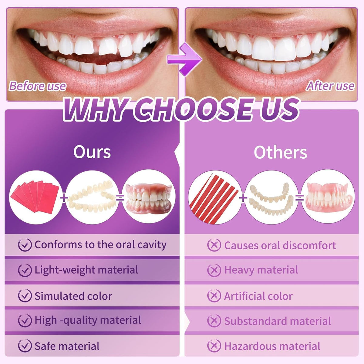 DIY Denture Kit Q626